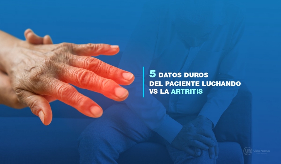 5 Datos Duros del Paciente luchando vs. la Artritis